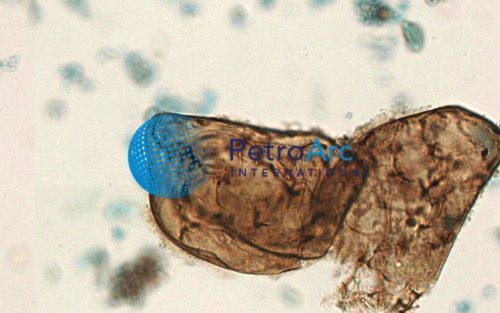 Entomoeba Histolyrica Trophozoites