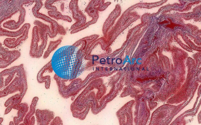  Human Fallopian Tube  200X PetroArc International