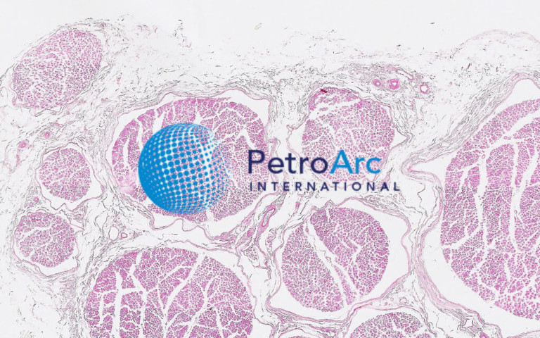 Medullated Nerve, 400X – PetroArc International