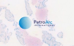 Human Placenta 1st Term