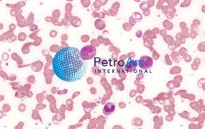 Human-Sickle-Cell-Anemia-100X - PetroArc International