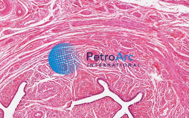 Human Simple Ciliated Columnar Epithelium, 400X – PetroArc International