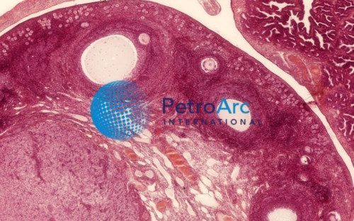Ovary Uterine Tube HE 10um